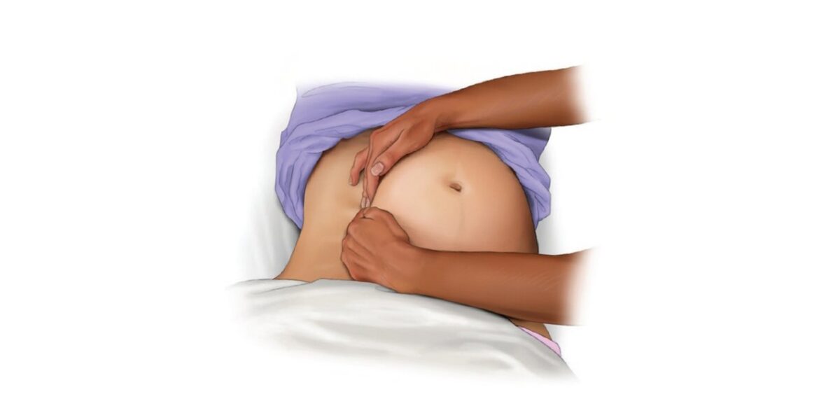 defibrillation-bei-schwangeren