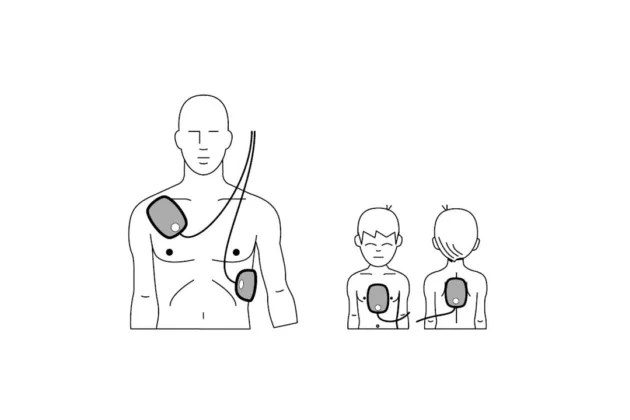 defibrillator-aed-elektroden-position