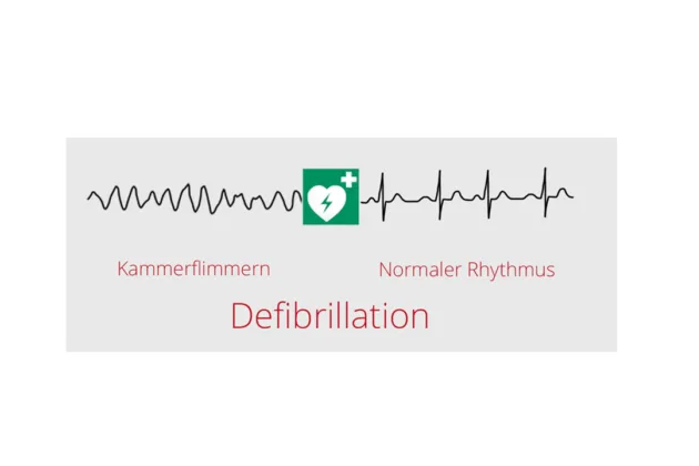 defibrillator-bedeutung